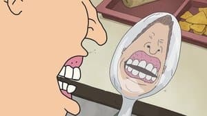 Braces