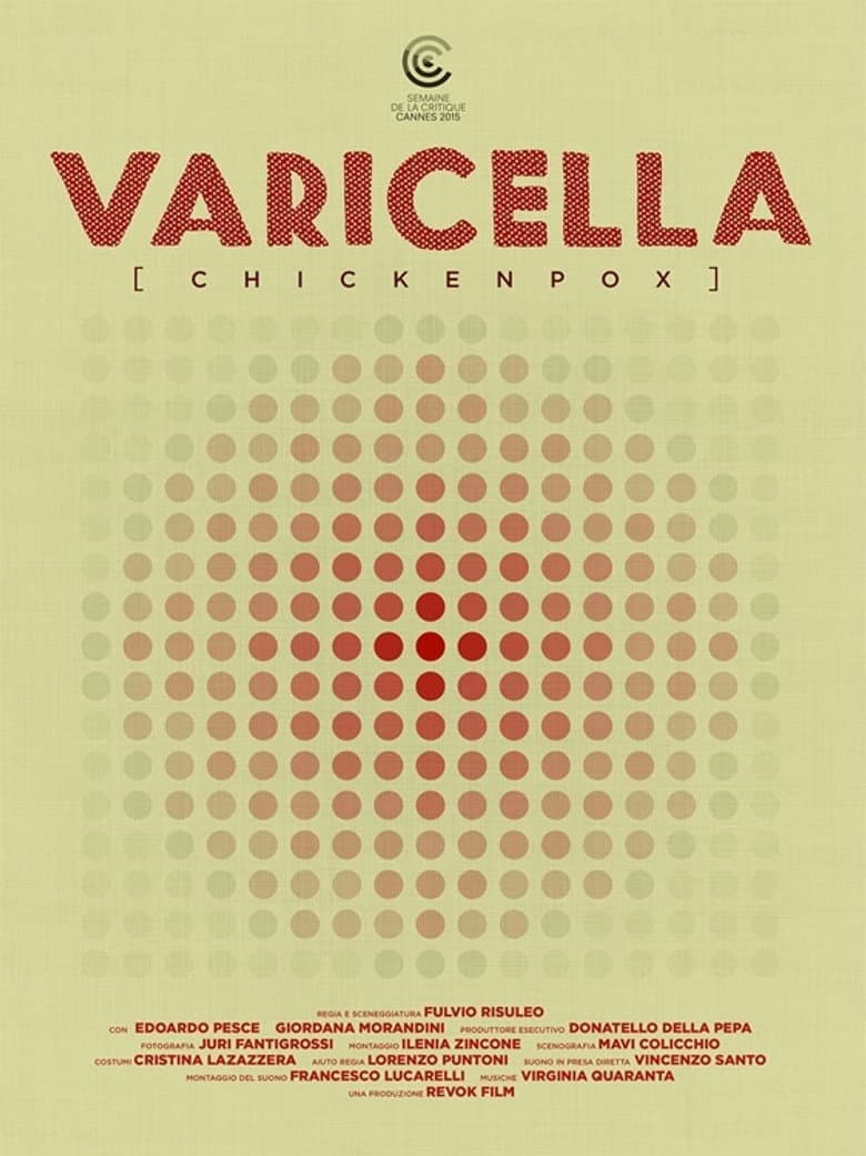 Varicella