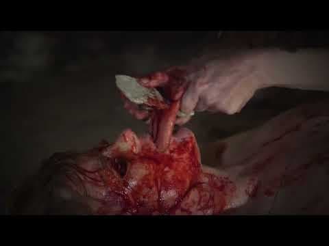 ROMANCE POST-MORTEM - TEASER - EXTREME!!!