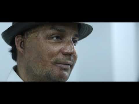 Beauty of life - Now streaming on Cinemapreneur | Documentary on Acid Attack | Documentary