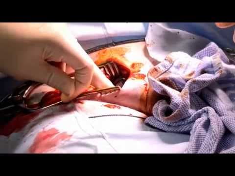 Embarrassing bodies ep 1